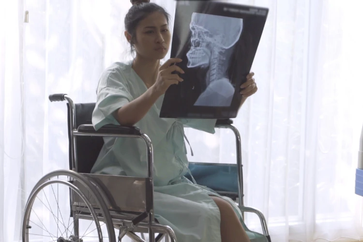 Traumatic-Brain-Injury-And-How-It-Qualifies-As-A-Disability a woman in a wheelchair looking at an x-ray for traumatic brain injury
