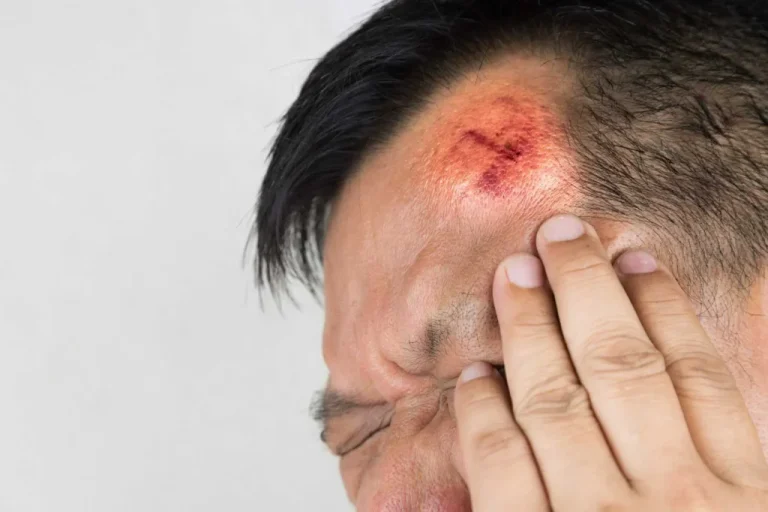 BLOG 6 Head Injury Attorney